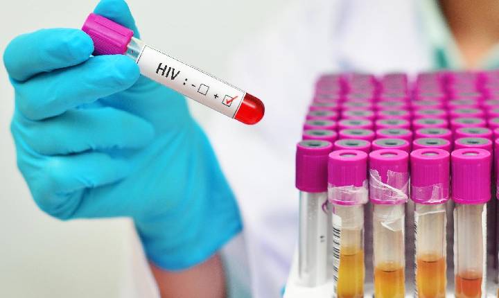 HIV: médicos anunciam 4º caso de cura.