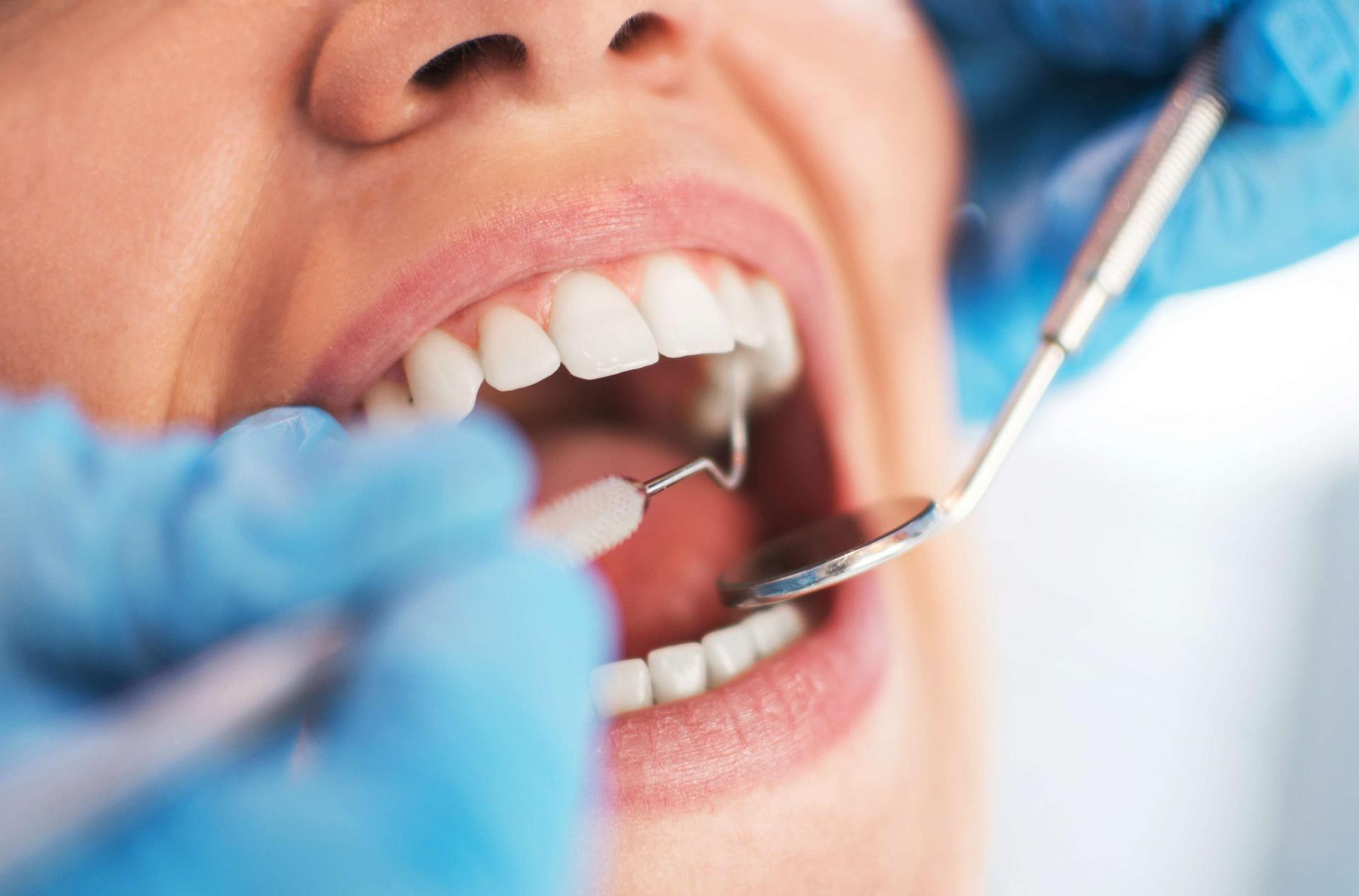 Teleconsultoria Odontológica da UNIFAL-MG auxilia profissionais da região no diagnóstico precoce de lesões na boca.